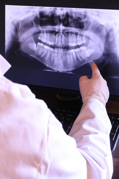 Best Emergency Tooth Extraction in Spring Hope, NC