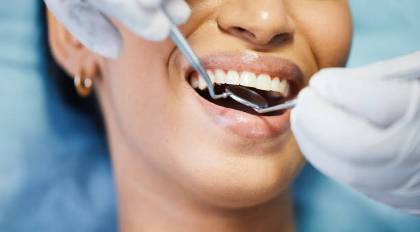 Best Emergency Gum Treatment in Spring Hope, NC