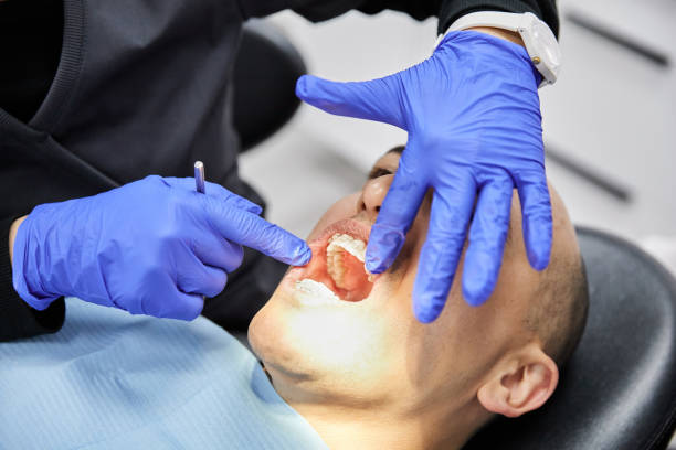 Best Emergency Wisdom Teeth Removal in Spring Hope, NC